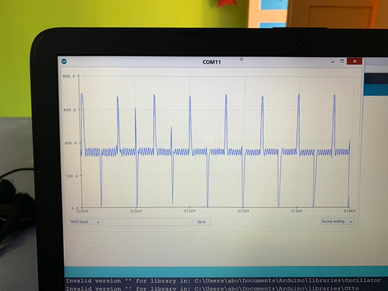 Low Cost ECG Monitoring System